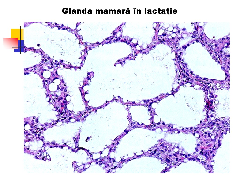 Glanda mamară în lactaţie